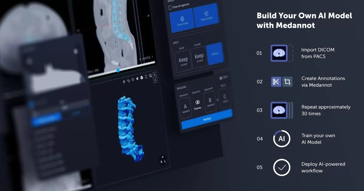 AI, které si vyvíjejí sami lékaři: Medannot automatizuje radiologická vyšetření, na rozvoj získává 300 tisíc eur